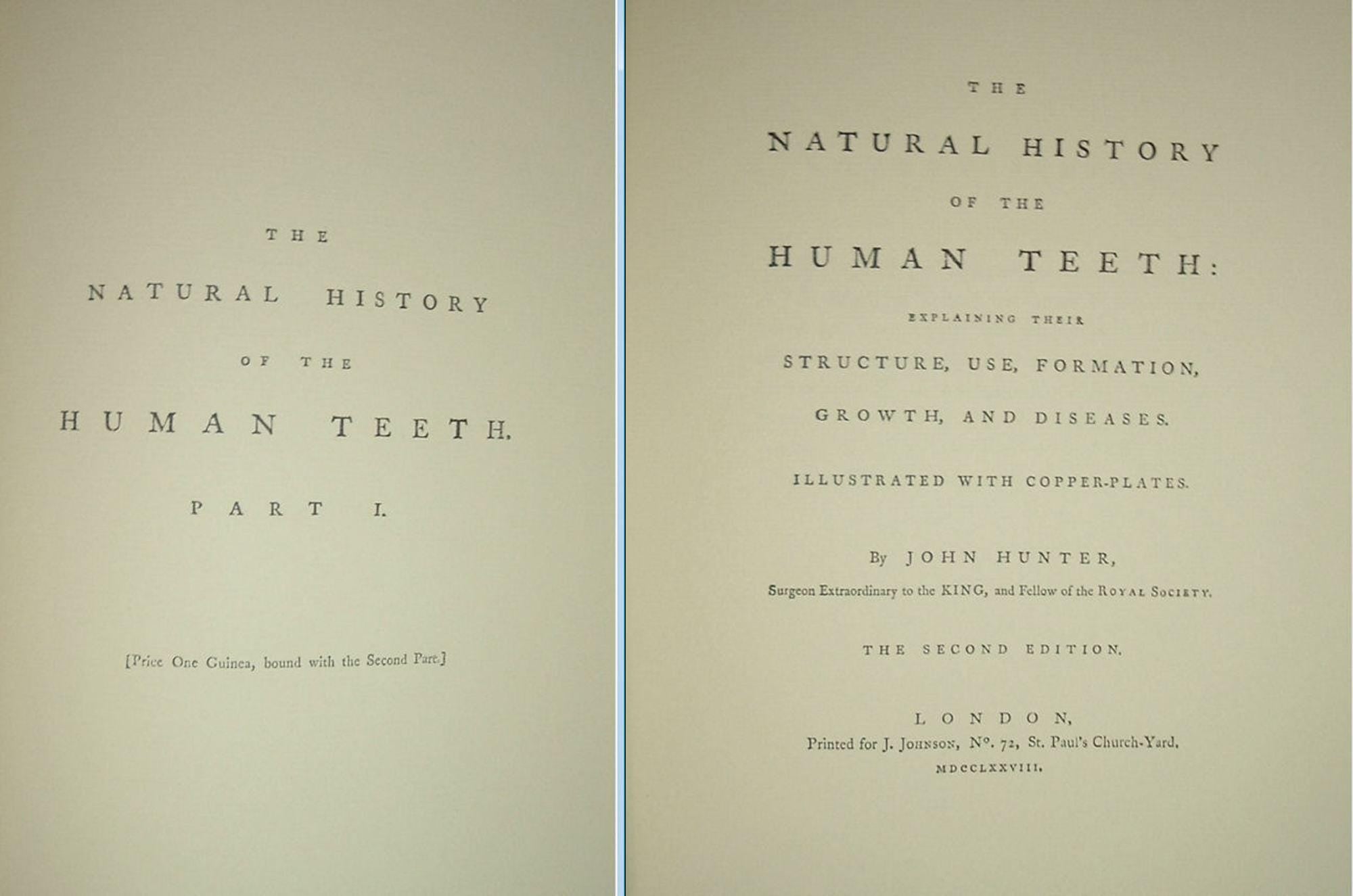 The Natural History of the Human Teeth by John Hunter Gryphon Editiions Full Leather 1979