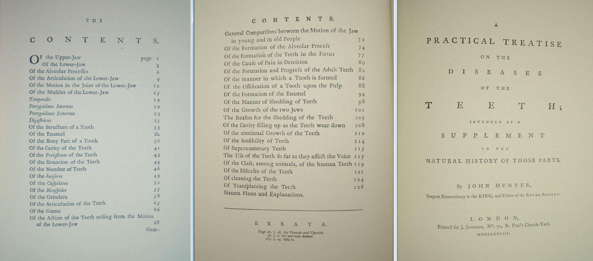 The Natural History of the Human Teeth by John Hunter Gryphon Editiions Full Leather 1979