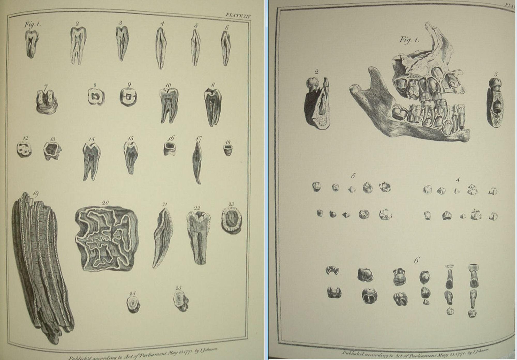 The Natural History of the Human Teeth by John Hunter Gryphon Editiions Full Leather 1979